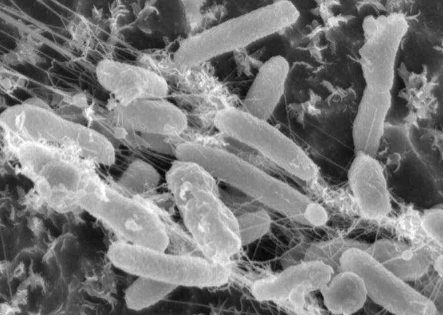 advantages of plastic eating bacteria
